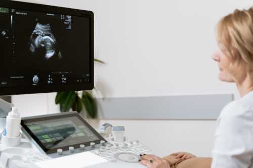 Ultrasound-service
